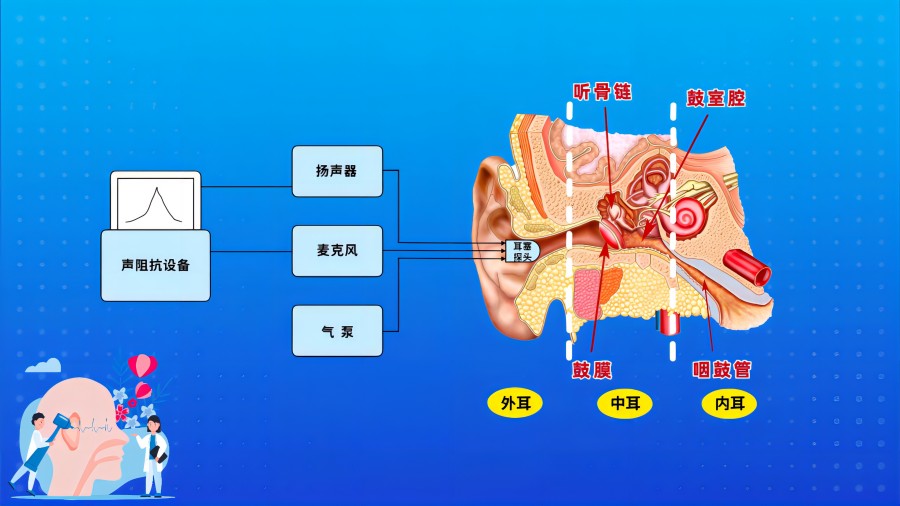 聲導抗檢查